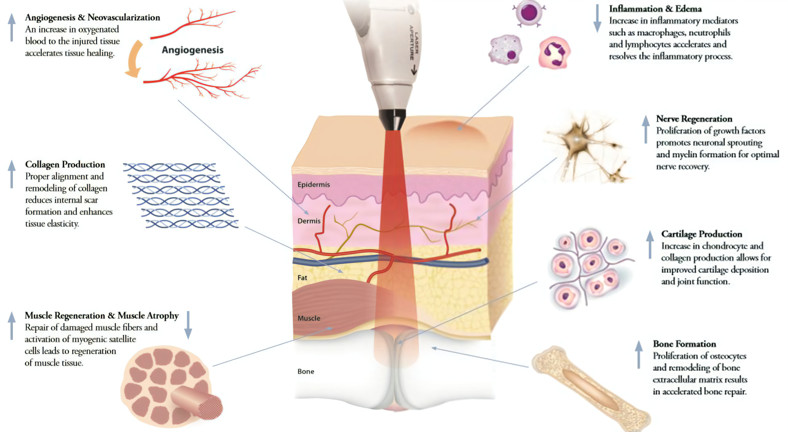 Cold Laser Therapy effects on body tissue